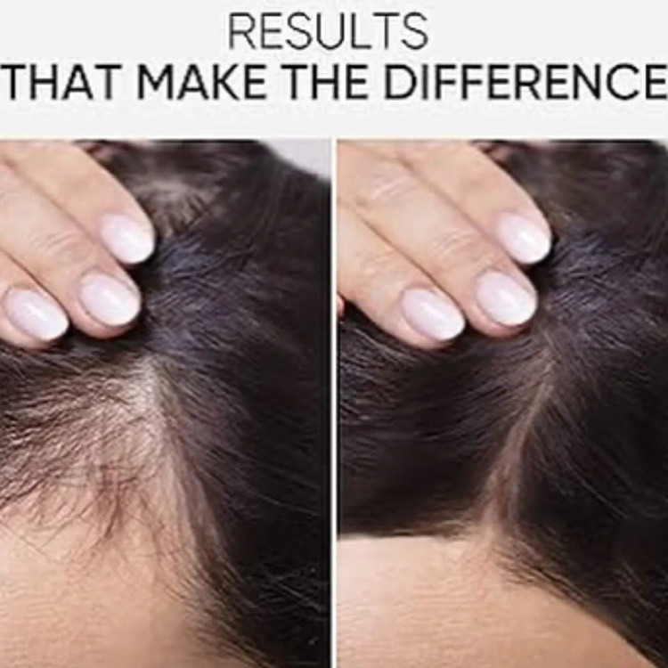 سرم اسکالپی سیپوری تقویت کننده و ضد ریزش مو اورجينال كره