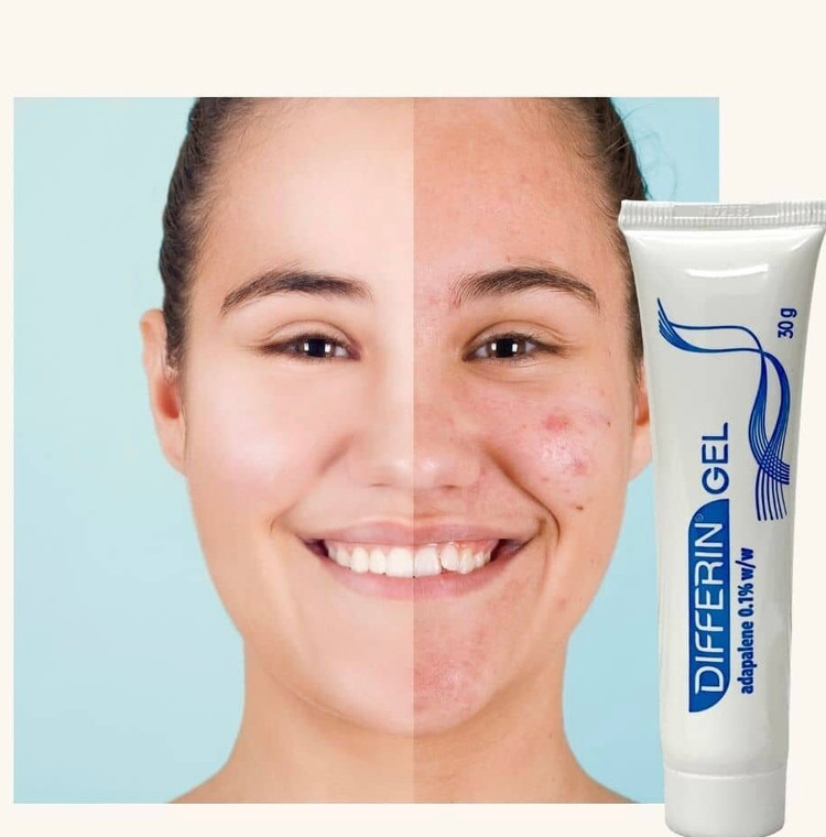 ژل ضد جوش دیفرین آداپالن اصل فرانسه