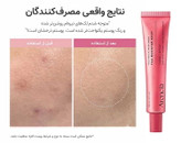 بوستر شات دور چشم و صورت TXA آرنسیا اصل ( ضد لک و روشن کننده قوی)