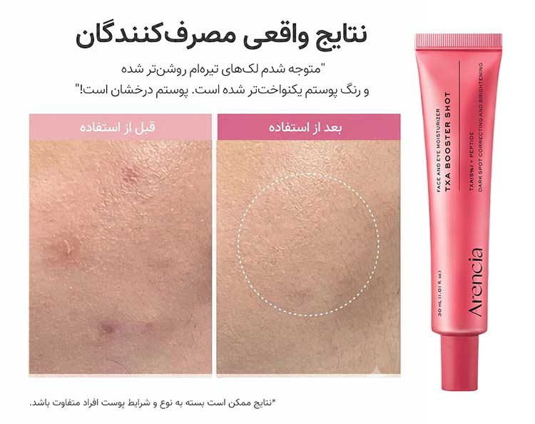 بوستر شات دور چشم و صورت TXA آرنسیا اصل ( ضد لک و روشن کننده قوی)