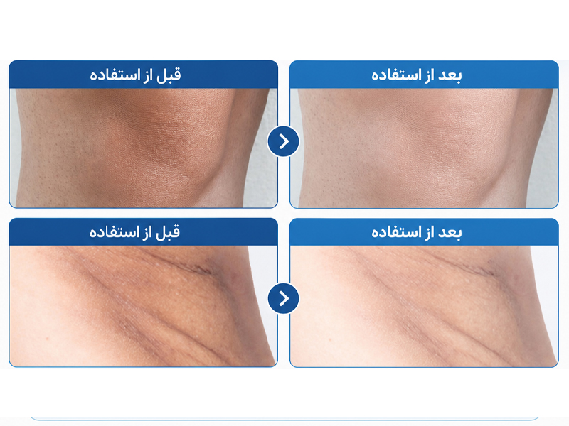 اسپری لایهبردار و روشن کننده صورت و بدن ترانزامیک اسید پیل شات (PS) دکتر ملاکسین